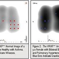 Dynamic lung ultrasound imaging