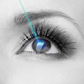 Laser για Μυωπία, Υπερμετρωπία, Αστιγματισμό & Πρεσβυωπία