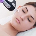 Fractional Laser Προσώπου