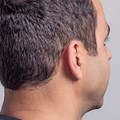 In-the-ear hearing aids