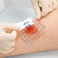 Patches and Pads for Wounds, Ulcers and Burns