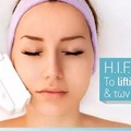 2 HIFU facial treatments