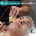 Σύσφιξη προσώπου με τη θεραπεία Remodeling