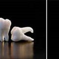 Oral surgery