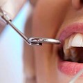 Dental cleaning