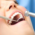 Dentistry aesthetics