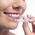 Invisalign