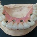 GKdental Lab - Κωνσταντόπουλος Γιώργος BSc