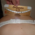 Scoliosis