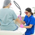 Αποτρίχωση με laser
