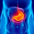 Laparoscopic cholecystectomy and treatment of cholelithiasis