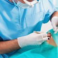 Surgical Procedures