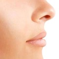 Rhinoplasty