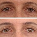 Antiaging - Regeneration