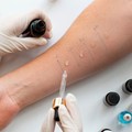 Δερματικές δοκιμασίες δια νυγμού (Skin Prick Tests)