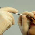 Clinical Examination - Endoscopy of the Nose