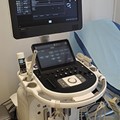 Color Doppler Ultrasound - Pregnant monitoring