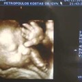3D, 4D Ultrasound