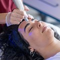 Dermapen