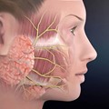 Restoration of the facial nerve