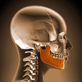 Tumors and Cysts in the Jaws