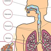 Voice disorders, Dysphonia