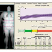 Μέτρηση οστικής μάζας