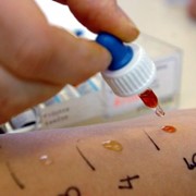 Επιδερμικά τεστ (skin prick tests)