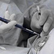 Χειρουργική Καταρράκτη