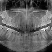 Digital Computed Panoramic - Cephalometric X-Rays