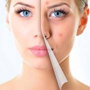 Enzymatic Facial Cleansing