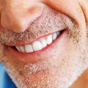 Ceramic crowns