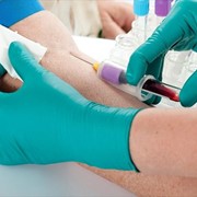 Paediatric blood sampling