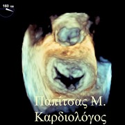 3D Διοισοφάγειο Υπερηχογράφημα