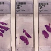 Τα πλακίδια φέρουν μοναδικό barcode με το επίθετο & αριθμό πρωτοκόλλου, για την καλύτερη δυνατή ταυτοποίηση δείγματος