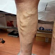 MOUSTOGIANNIS PETROS MD, MSc: Photos