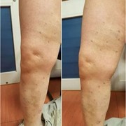 MOUSTOGIANNIS PETROS MD, MSc: Photos