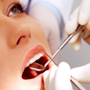 Dental cleaning