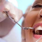 Veneers, resin veneers