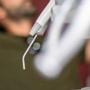 Αφαίρεση έντονων τρυγιακών εναποθέσεων (πέτρας) και χρωστικών