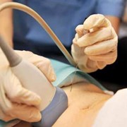 Dr Παναγιώτα Παπασωζομένου - Αμνιοπαρακέντηση