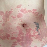 customer.pip_photo6_desc_descr