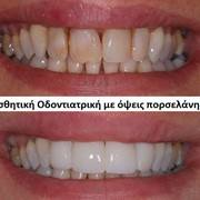 customer.pip_photo3_desc_descr