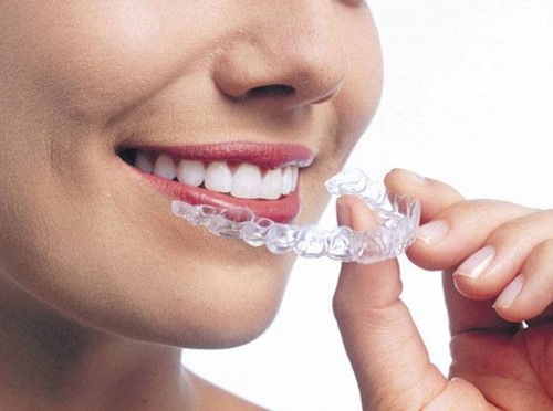 Invisalign