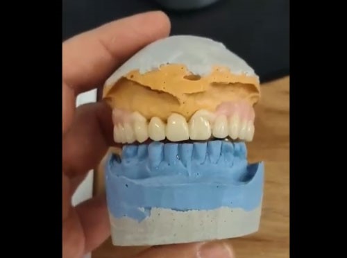 GKdental Lab - Κωνσταντόπουλος Γιώργος BSc
