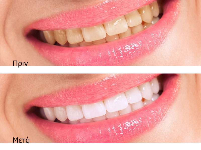 ABSOLUTE DENTAL CENTER: Φωτογραφίες & Βίντεο