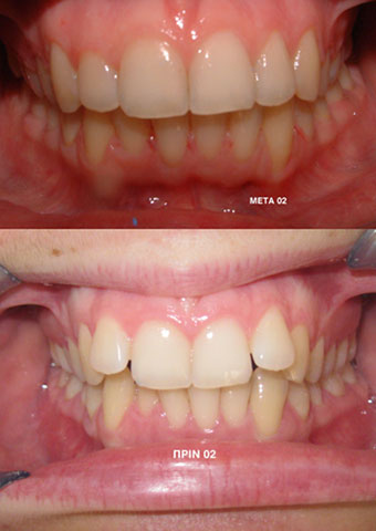 ΑΛΕΞΙΑΔΗΣ ΓΙΑΝΝΗΣ - ΑΛΕΞΙΑΔΗ ΔΗΜΗΤΡΑ: Φωτογραφίες & Βίντεο