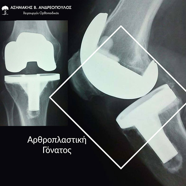 ΑΝΔΡΕΟΠΟΥΛΟΣ ΑΣΗΜΑΚΗΣ: Φωτογραφίες & Βίντεο