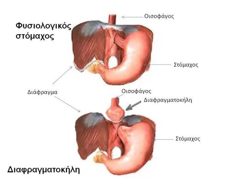 ΑΡΒΑΝΙΤΗ ΒΑΣΙΛΙΚΗ: Φωτογραφίες & Βίντεο