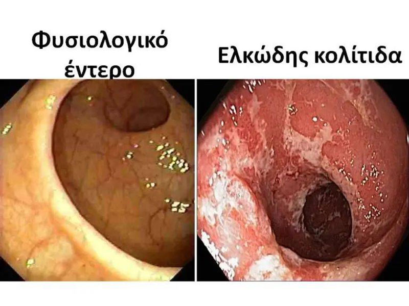 ΑΡΒΑΝΙΤΗ ΒΑΣΙΛΙΚΗ: Φωτογραφίες & Βίντεο